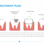 Dental-Treatment-Plan-Template